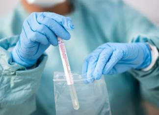 Vin două milioane de teste pentru coronavirus – ce categorii de pacienți vor fi testați?