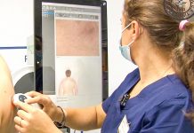 Inteligența Artificială este folosită în cabinetul de dermatologie al Spitalului CF Timișoara pentru analizarea alunițelor în vederea depistării precoce a cancerului de piele. Aparatul din Ambulatoriu care realizează harta leziunilor la nivelul pielii