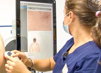 Inteligența Artificială este folosită în cabinetul de dermatologie al Spitalului CF Timișoara pentru analizarea alunițelor în vederea depistării precoce a cancerului de piele. Aparatul din Ambulatoriu care realizează harta leziunilor la nivelul pielii