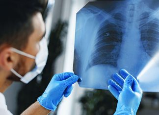 1 din 15 bărbați români riscă să fie diagnosticat cu cancer pulmonar până la 75 de ani