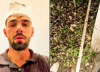 Scandal la ieșirea dintr-un club din oraș: dosar penal pentru lovire și tulburarea ordinii publice, sportivii bătăuși dați afară din lotul Politehnicii Timișoara