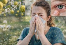 A început sezonul alergiilor. Un medic alergolog din Timișoara explică simptomele și cum pot fi tratate