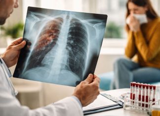 Ziua Mondială de Luptă Împotriva Tuberculozei: Boala care poate fi vindecată dacă este depistată la timp